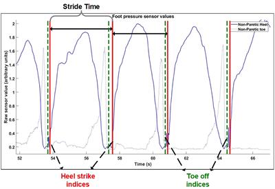 Differences in Muscle Synergy Symmetry Between Subacute Post-stroke Patients With Bioelectrically-Controlled Exoskeleton Gait Training and Conventional Gait Training